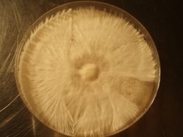 petri_agar.jpg
