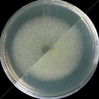 Aspergillus_fumigatus-Malt_recto_verso.jpg