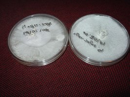 PleuroPlaca.JPG