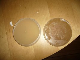 comparacao agar.JPG