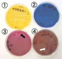 Differentiation_Ecoli_Salm.jpg