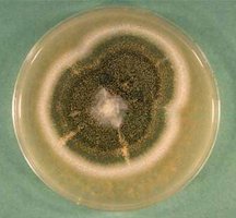 Aspergillus_nidulaus.jpg