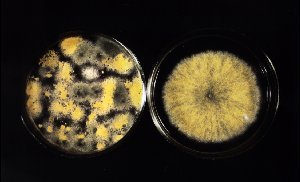 aspergillus4.jpg
