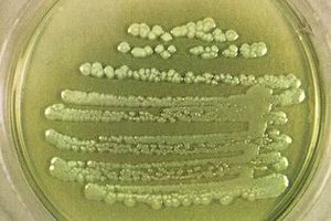 P.aeruginosa_colonies.jpg