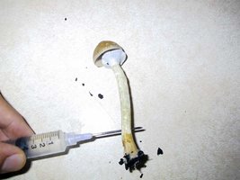 326497277-biopsy.jpg