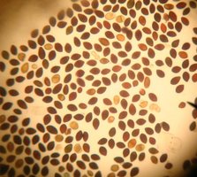 Panaeolus_subbalteatus.spores.jpg