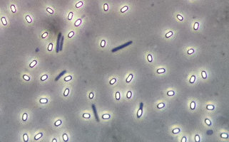 endosporo.jpg
