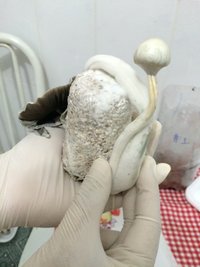 a - retirando com torção.JPG