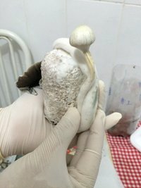 b - retirando com torção.JPG
