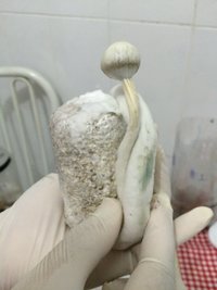 c - retirando com torção.JPG