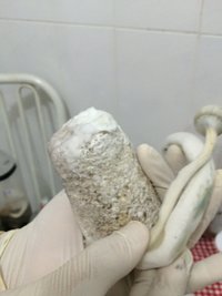 e - retirando com torção.JPG