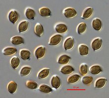 psilocybe-caerulescens-spores_1000xdic.jpg