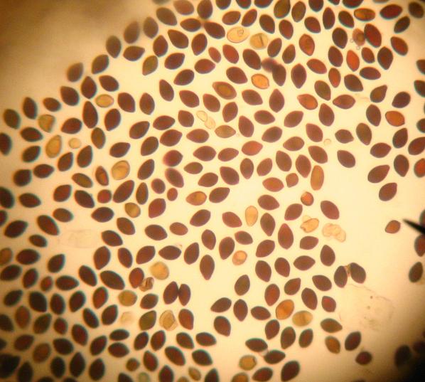 Panaeolus_subbalteatus.spores.jpg